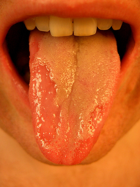 A decidedly bashed up winewriter's tongue after a week of tasting Riesling in Germany.